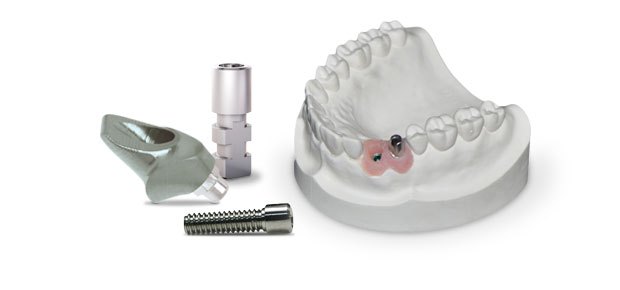 pro-fit abutments