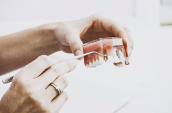 removable prosthodontics